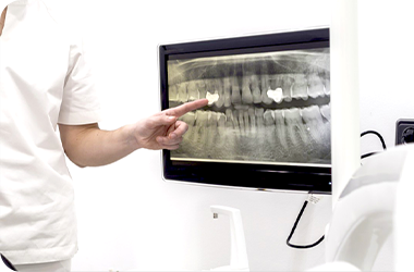 顎の骨が足りない方・薄い方