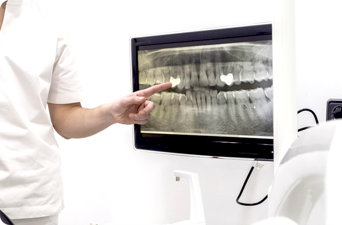 顎の骨が足りない方・薄い方