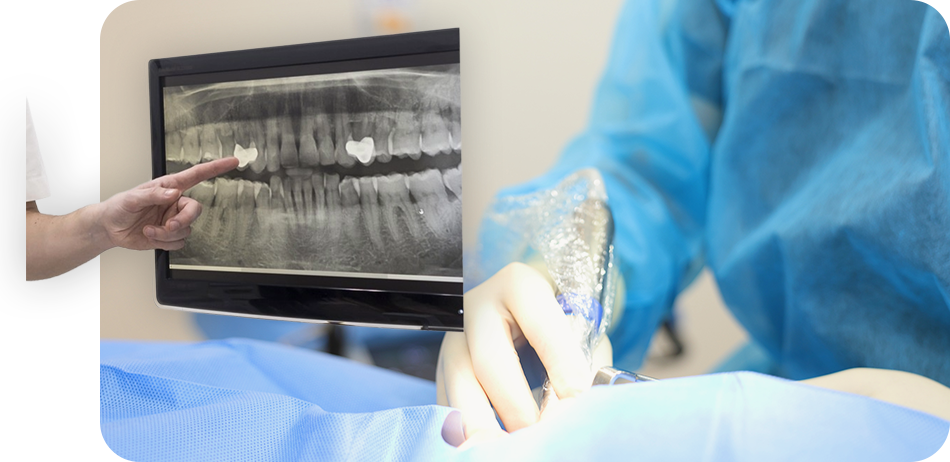 骨や歯ぐきの状態に合わせた柔軟なインプラント治療