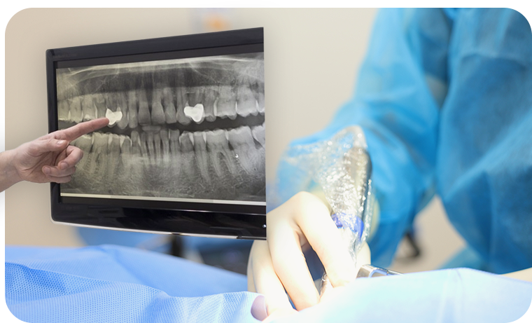 骨や歯ぐきの状態に合わせた柔軟なインプラント治療